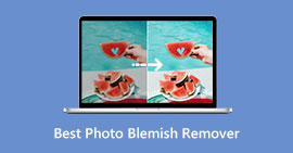 Bedste Foto Blemish Remover