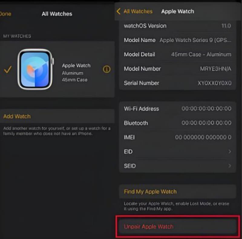 Unpair Apple Watch
